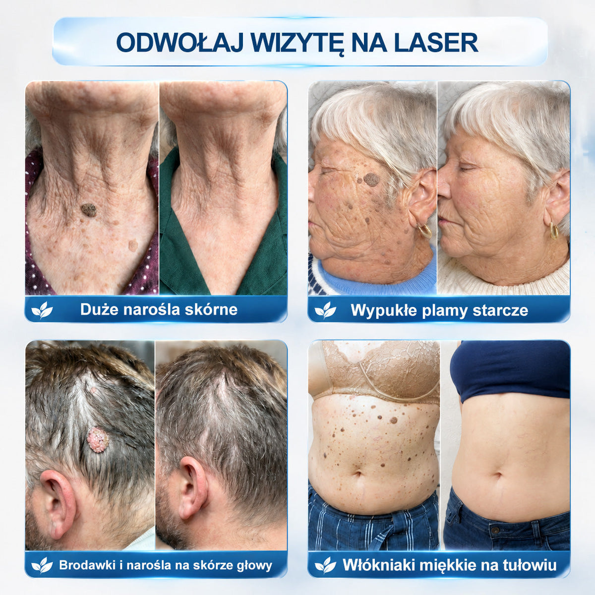 🍀🍀👑Ximonth® 7 𝑫𝒏𝒊 𝑷𝒓𝒆𝒑𝒂𝒓𝒂𝒕 𝑫𝒐 𝑼𝒔𝒖𝒘𝒂𝒏𝒊𝒂 𝑾łó𝒌𝒏𝒊𝒂𝒌ó𝒘 𝑴𝒊ę𝒌𝒌𝒊𝒄𝒉 𝑰 𝑷𝒓𝒛𝒆𝒃𝒂𝒓𝒘𝒊𝒆ń(𝐁𝐞𝐳 𝐁ó𝐥𝐮, 𝐁𝐞𝐳 𝐁𝐥𝐢𝐳𝐧 – 𝐑𝐨𝐥𝐥-𝐨𝐧)