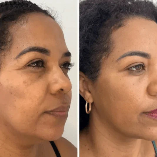 Collagen Fit™ – maska odmładzająca z kolagenem
