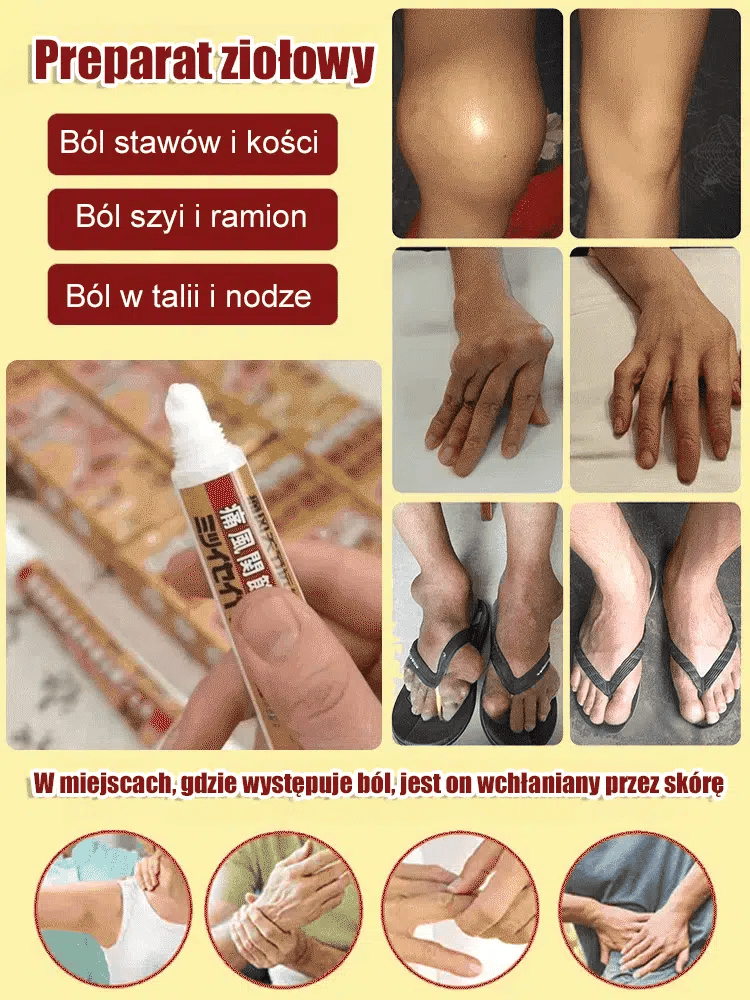 Żel medyczny na stawy na dnę moczanową Nie znoś ataków dny moczanowej! Żel szybko się wchłania, działa w ciągu 10 minut i łagodzi obrzęk i ból!