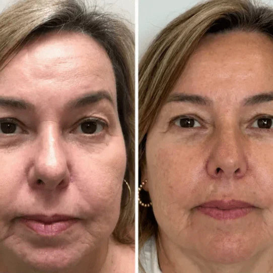 Collagen Fit™ – maska odmładzająca z kolagenem