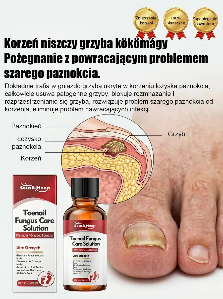 【Bezbolesna wymiana paznokci】Ziołowy łagodny płyn do naprawy paznokci dotkniętych grzybicą