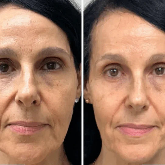 Collagen Fit™ – maska odmładzająca z kolagenem