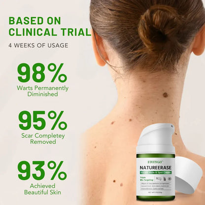 ✅ Oficjalny sklep: Fivfivgo™ NatureErase Instant Mole & Spot Cream