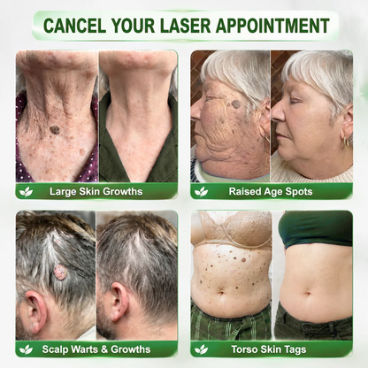 Ximonth® 𝑷𝑫𝑹𝑵 𝑨𝒏𝒕𝒊-𝑨𝒈𝒊𝒏𝒈 & 𝑻𝒂𝒓𝒈𝒆𝒕𝒆𝒅 𝑺𝒑𝒐𝒕 𝑹𝒆𝒏𝒆𝒘𝒂𝒍 𝑺𝒕𝒊𝒄𝒌（𝑯𝒆𝒍𝒑𝒔 𝑺𝒎𝒐𝒐𝒕𝒉 𝑾𝒓𝒊𝒏𝒌𝒍𝒆𝒔, 𝑺𝒖𝒑𝒑𝒐𝒓𝒕 𝑭𝒊𝒓𝒎𝒆𝒓-𝑳𝒐𝒐𝒌𝒊𝒏𝒈 𝑺𝒌𝒊𝒏, 𝑰𝒎𝒑𝒓𝒐𝒗𝒆 𝑻𝒉𝒆 𝑨𝒑𝒑𝒆𝒂𝒓𝒂𝒏𝒄𝒆 𝑶𝒇 𝑽𝒊𝒔𝒊𝒃𝒍𝒆 𝑺𝒑𝒐𝒕𝒔）