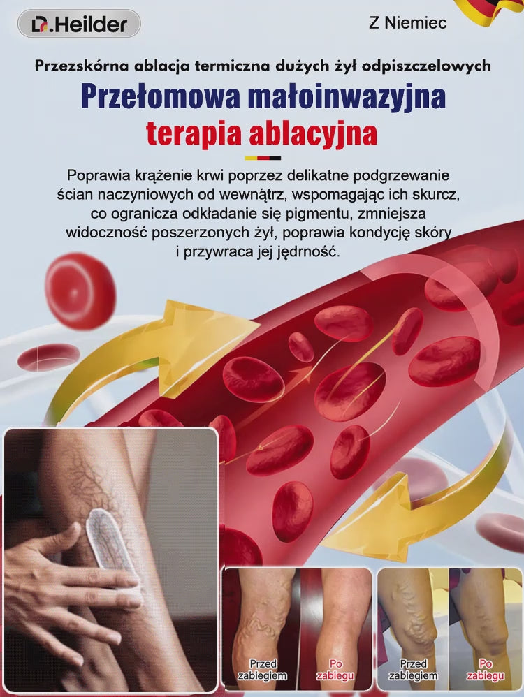 Krem na żylaki. Darmowa wysyłka w ciągu 24 godzin